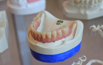 Рент а кар Скопје | Zubna tehnika